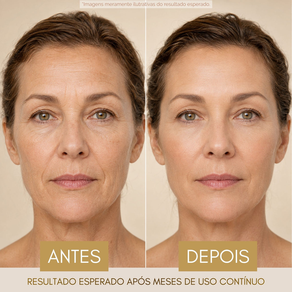 CREME IMUNOLÓGICO REJUVENESCEDOR ANTES E DEPOIS